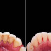Deep cleaning 4 quadrants