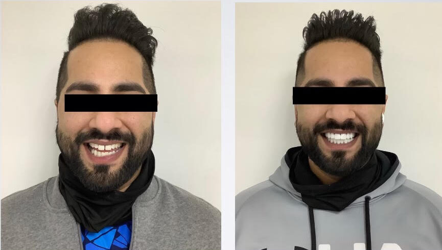 dentist mexico reviews